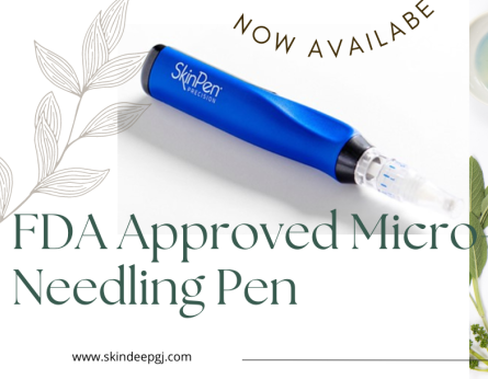 FDA Approved Micro-Needling Pen now offered at Skin Deep