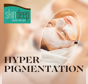hyperpigmentation solutions - new blog post by Skin Deep GJ